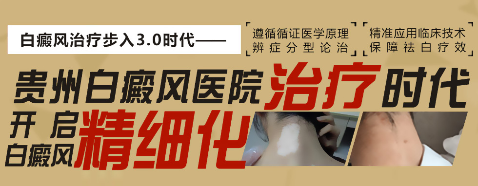 治疗白癜风 健康才是硬道理