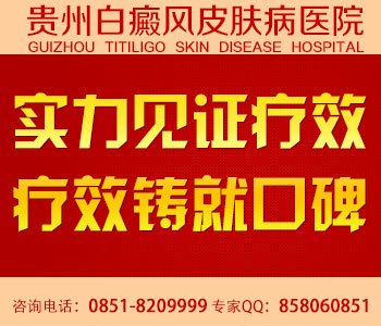白癜风治疗偏方都有哪些呢