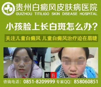 白癜风患者应该采取哪些保健措施呢