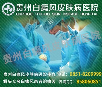 引起白癜风几种原因有哪些