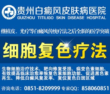 白癜风诊断方法是什么