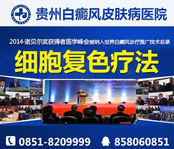 诊断白癜风的方法有哪些