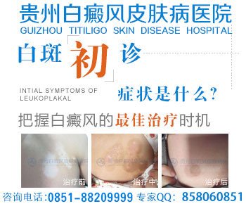 贵州好白癜风医院是什么医院