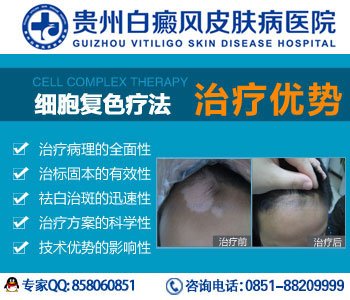 贵州华厦白癜风医院