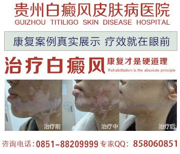 贵州皮肤病白癜风研究院