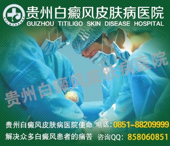 贵州治疗白癜风好医院