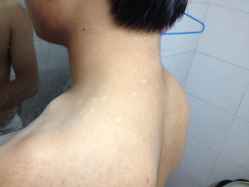 安顺那家医院医院看白癜风好