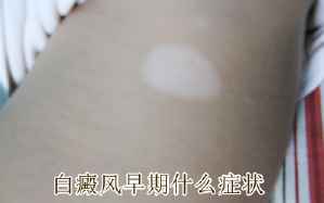 贵州最权威的白殿风医院